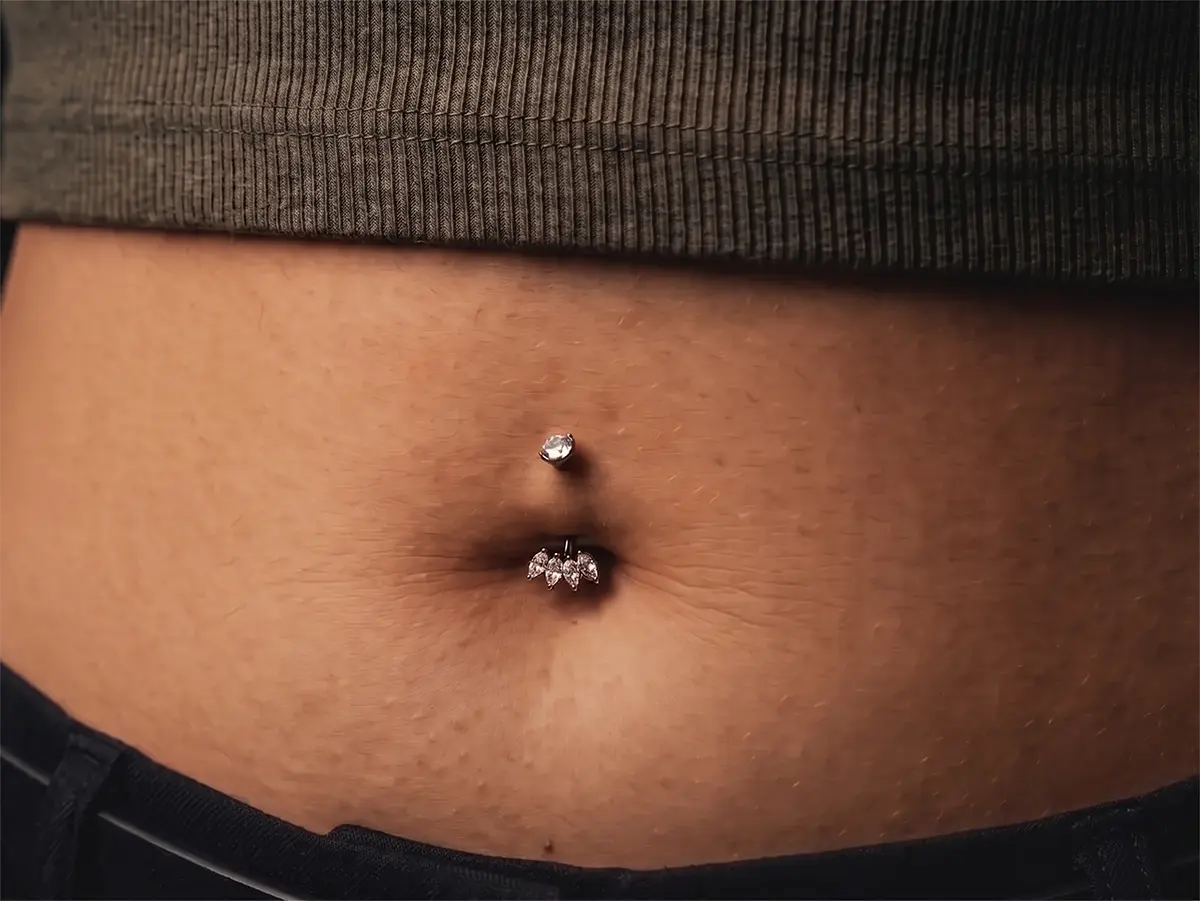 Klasik Navel