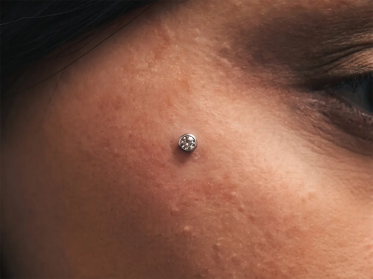 Yüz Bölgesi Dermal